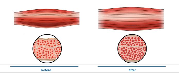 Dermato esthétique : questions réponses sur l’Emsculpt®