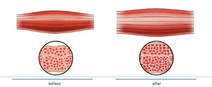 Dermato esthétique : questions réponses sur l’Emsculpt®