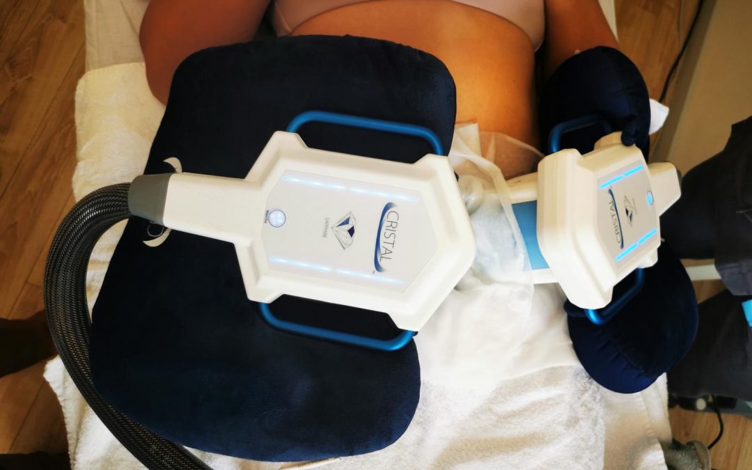 Les 6 avantages de la cryolipolyse